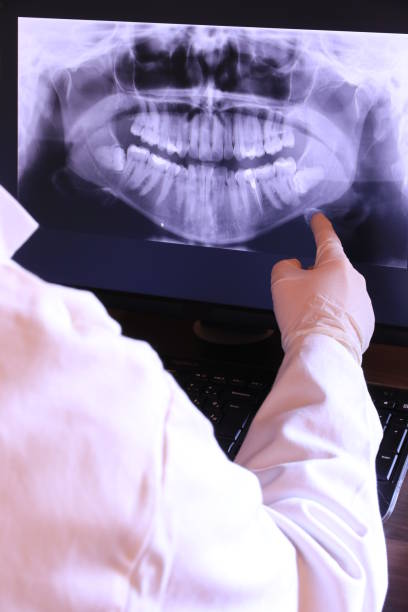 Best Emergency Root Canal Treatment in Lake Waynoka, OH