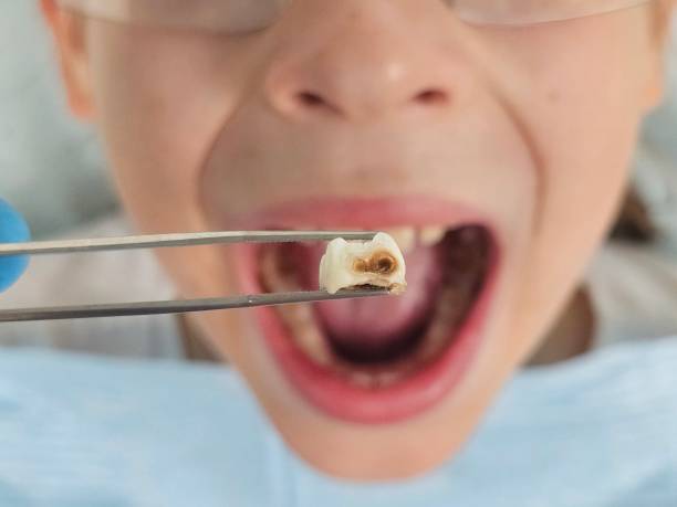 Best Emergency Treatment for Toothache in Lake Waynoka, OH